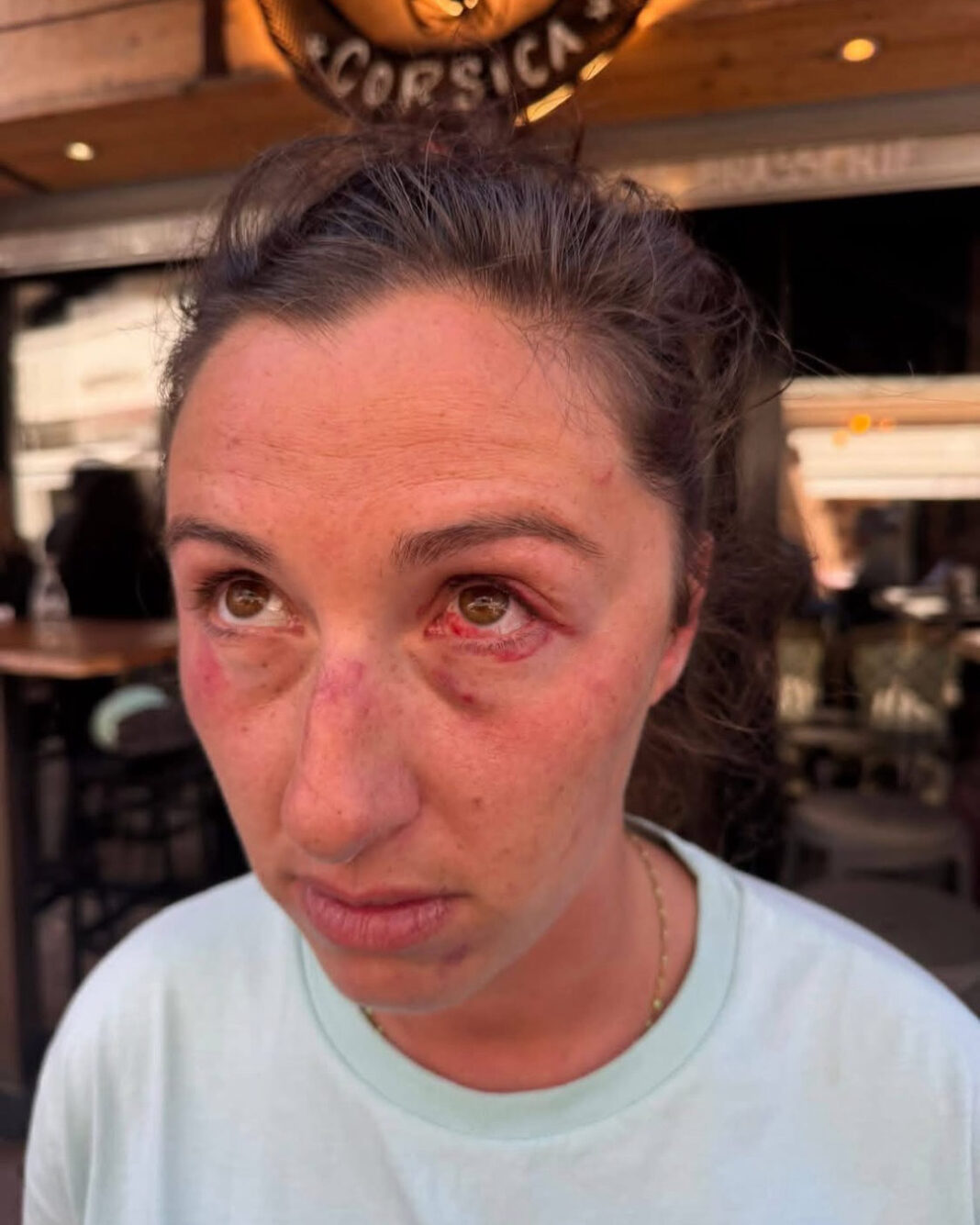 A Porto-Vecchio, l’agression qui dit l’effondrement des normes A Porto-Vecchio, l’agression qui dit l’effondrement des normes